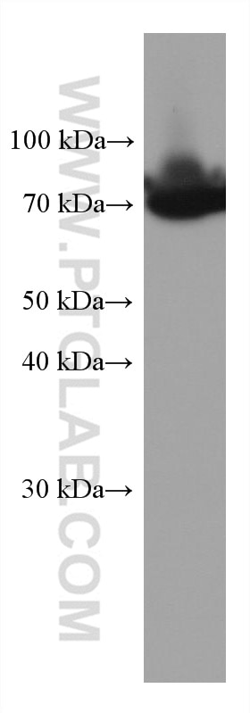 Western Blot (WB) analysis of human plasma using SERPIND1 Monoclonal antibody (67602-1-Ig)