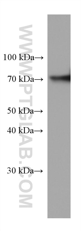Western Blot (WB) analysis of human placenta tissue using SERPIND1 Monoclonal antibody (67602-1-Ig)