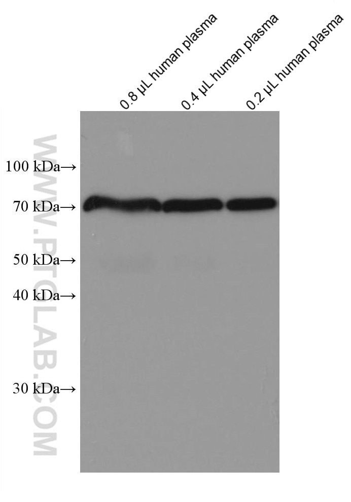 Western Blot (WB) analysis of various lysates using SERPIND1 Monoclonal antibody (67602-1-Ig)