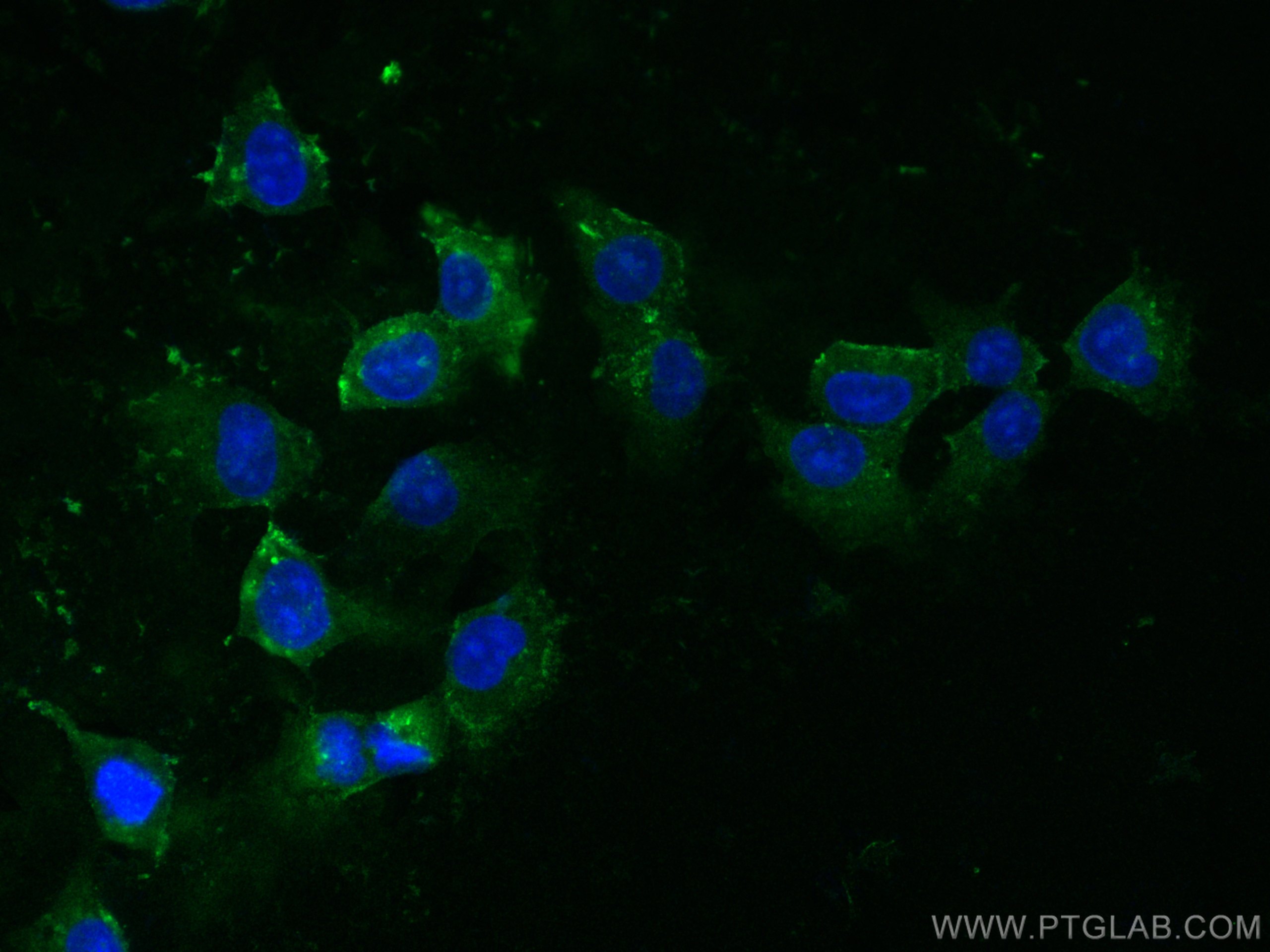 Immunofluorescence (IF) / fluorescent staining of HUVEC cells using PAI-1 Polyclonal antibody (13801-1-AP)