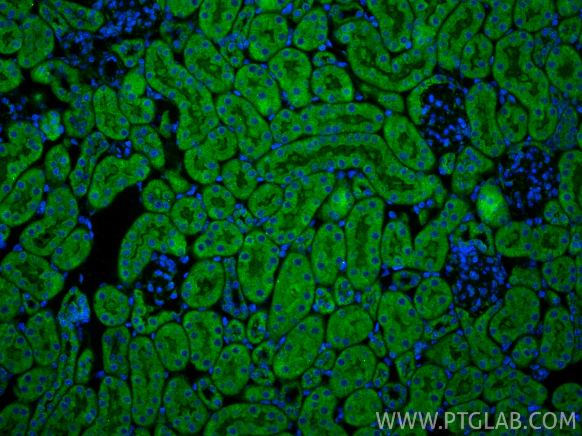 IF Staining of mouse kidney using 13801-1-AP Immunofluorescence (IF) / fluorescent staining of mouse kidney tissue using Serpin E1/PAI-1 Polyclonal antibody (13801-1-AP)