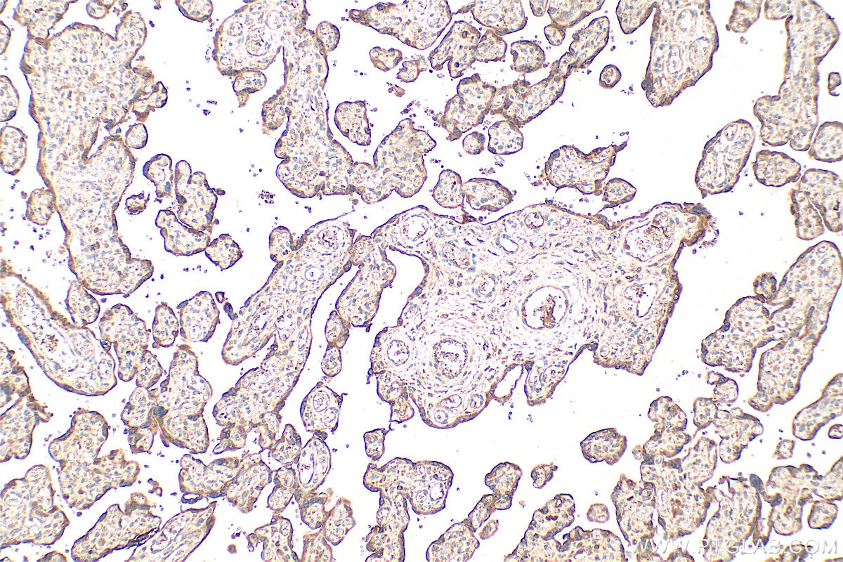 Immunohistochemistry (IHC) staining of human placenta tissue using Serpin E1/PAI-1 Polyclonal antibody (13801-1-AP)