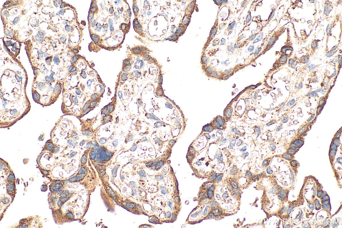 Immunohistochemistry (IHC) staining of human placenta tissue using Serpin E1/PAI-1 Polyclonal antibody (13801-1-AP)