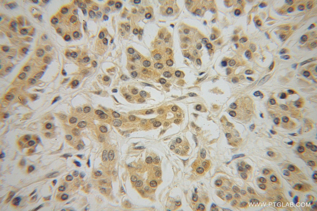 PAI-1 Polyclonal antibody