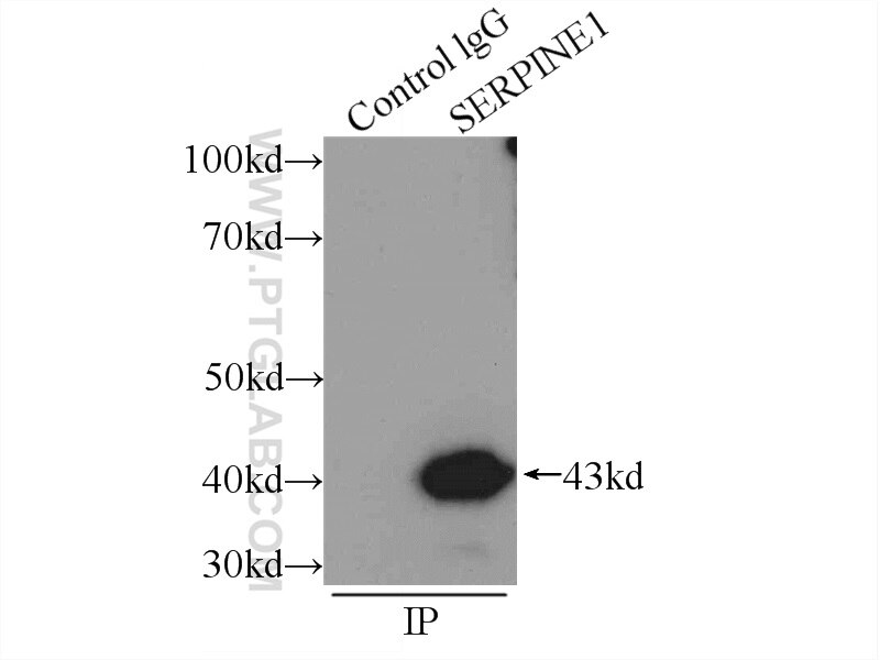 PAI-1 Polyclonal antibody