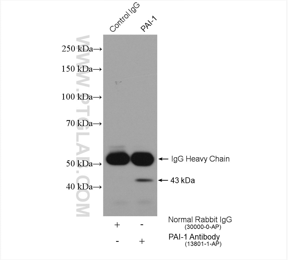 Immunoprecipitation (IP) experiment of HepG2 cells using PAI-1 Polyclonal antibody (13801-1-AP)