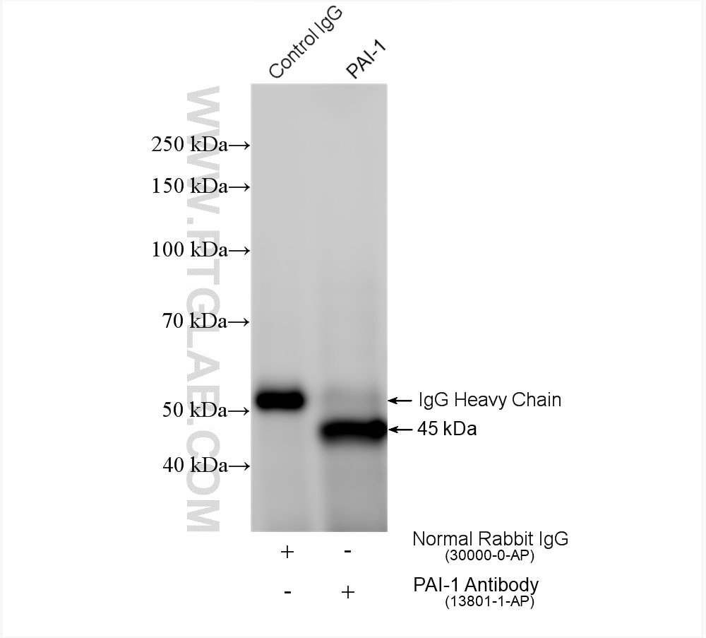 Immunoprecipitation (IP) experiment of HepG2 cells using PAI-1 Polyclonal antibody (13801-1-AP)