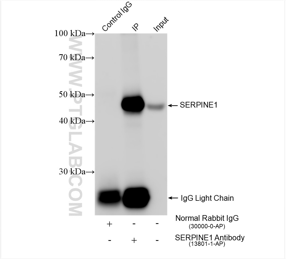 Immunoprecipitation (IP) experiment of HUVEC cells using Serpin E1/PAI-1 Polyclonal antibody (13801-1-AP)