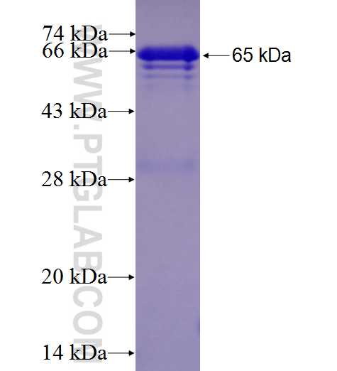 SERPINE1 fusion protein Ag4777 SDS-PAGE
