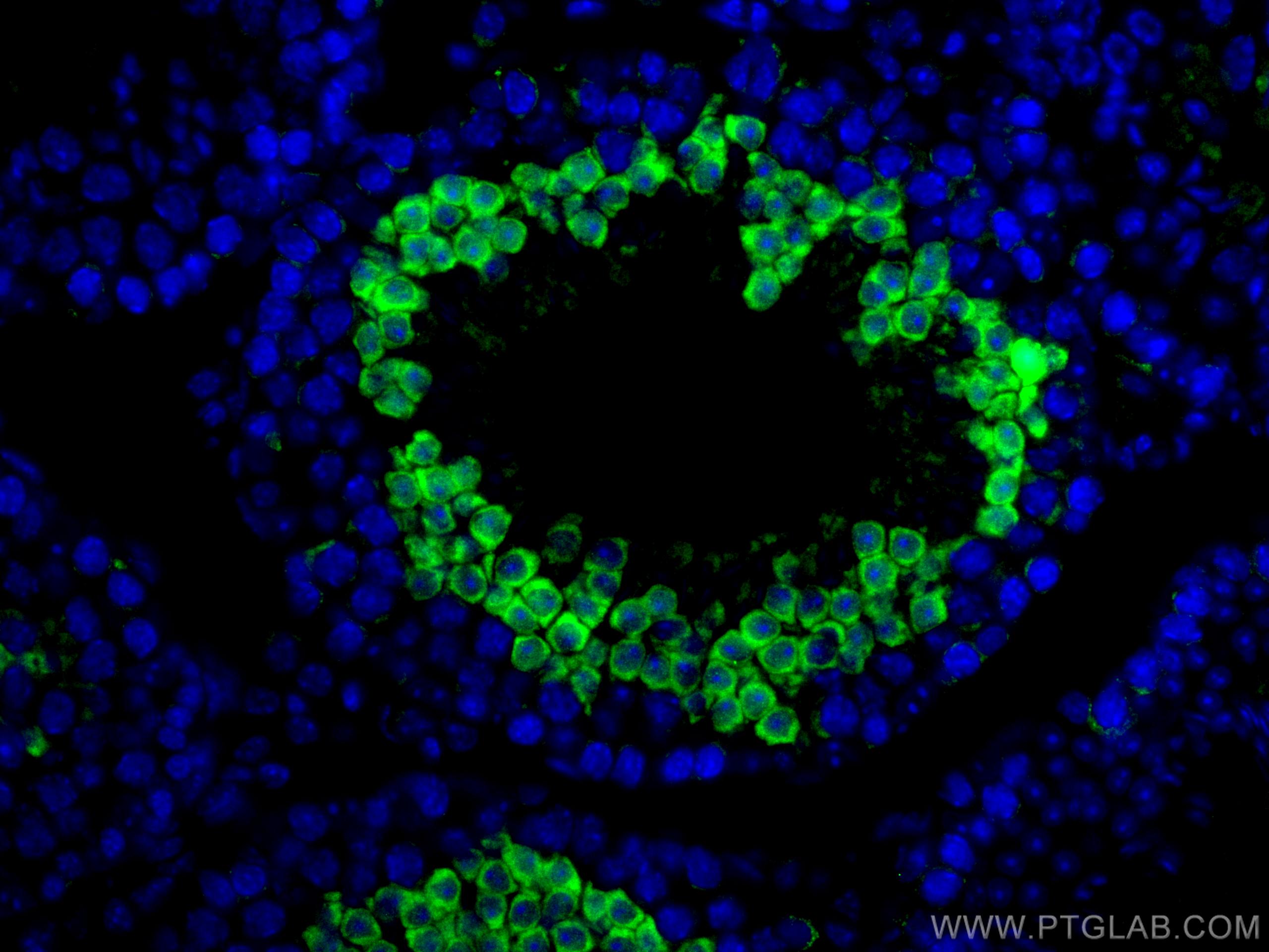 Immunofluorescence (IF) / fluorescent staining of human testis tissue using SERPINE2 Polyclonal antibody (11303-1-AP)