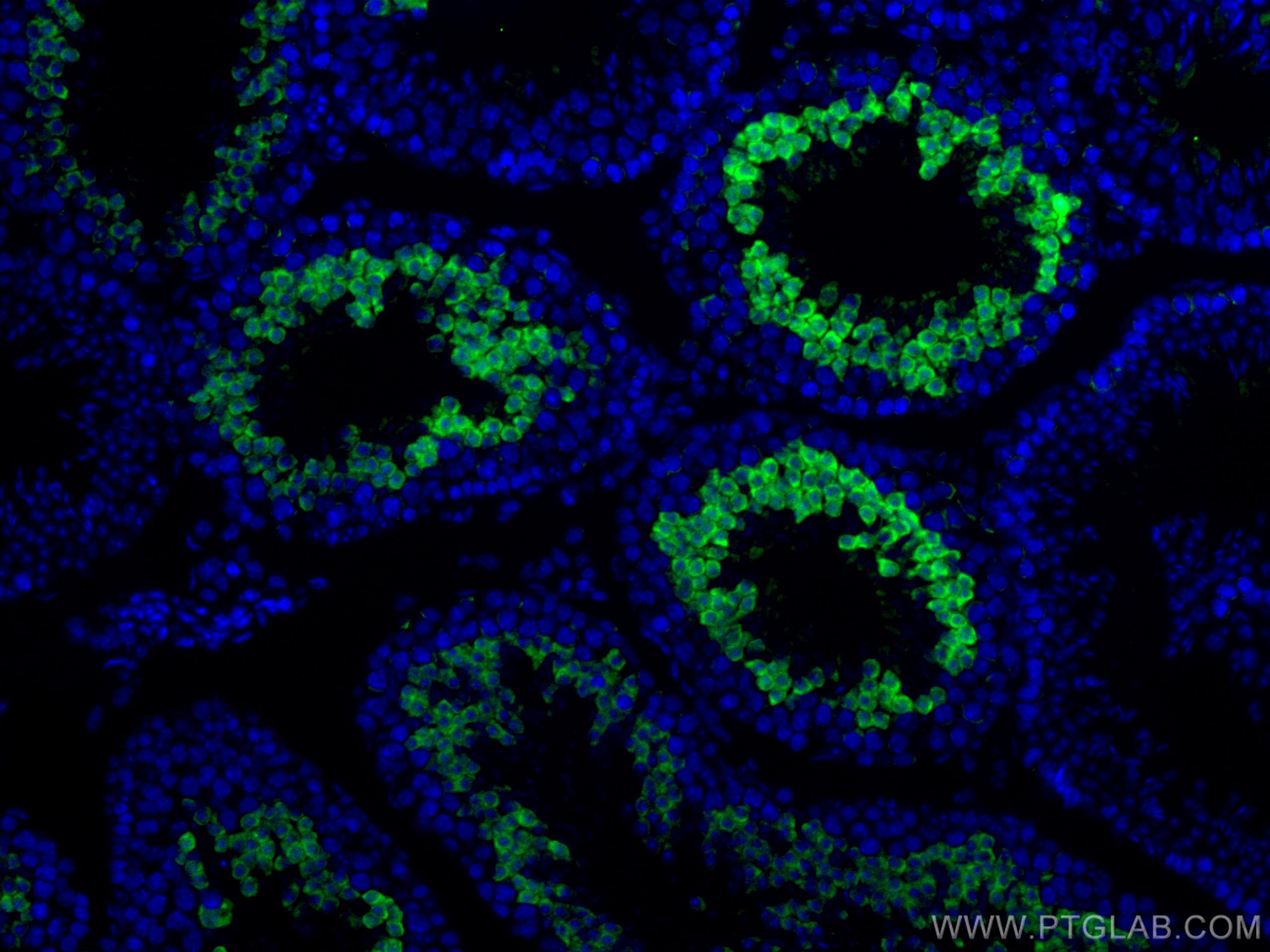 Immunofluorescence (IF) / fluorescent staining of human testis tissue using SERPINE2 Polyclonal antibody (11303-1-AP)