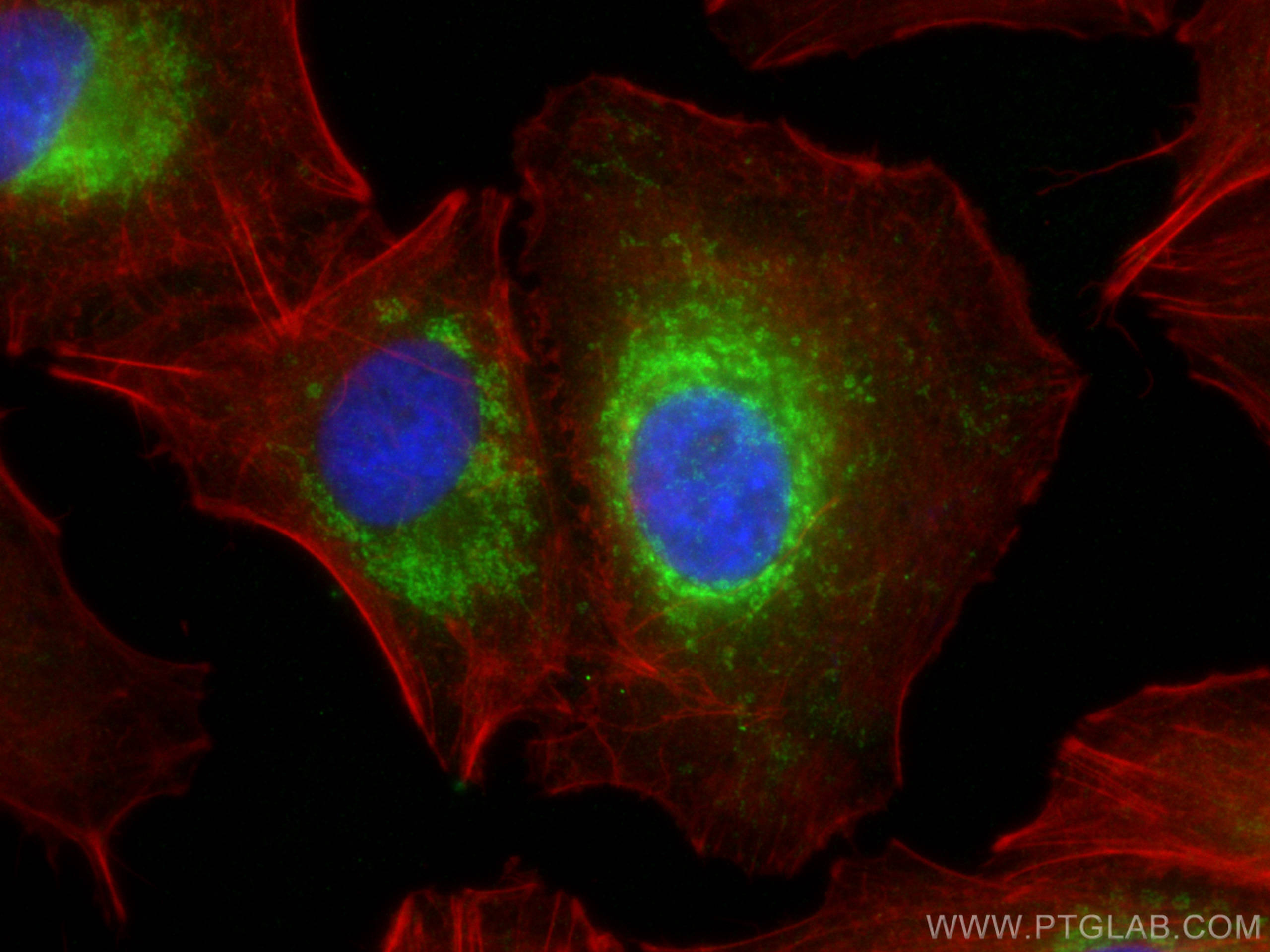 Immunofluorescence (IF) / fluorescent staining of A549 cells using SERPINE2 Polyclonal antibody (11303-1-AP)