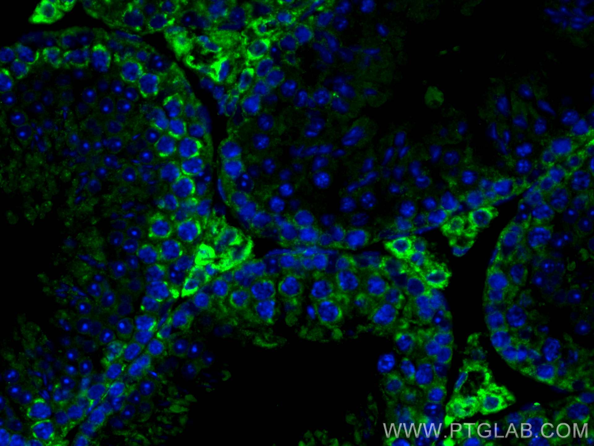 Immunofluorescence (IF) / fluorescent staining of mouse testis tissue using SERPINE2 Polyclonal antibody (11303-1-AP)
