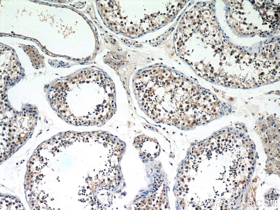 Immunohistochemistry (IHC) staining of human testis tissue using SERPINE2 Polyclonal antibody (11303-1-AP)