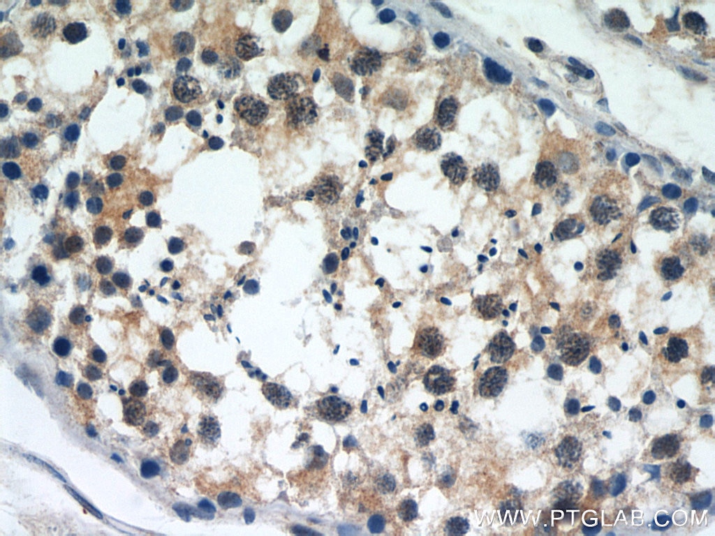 Immunohistochemistry (IHC) staining of human testis tissue using SERPINE2 Polyclonal antibody (11303-1-AP)