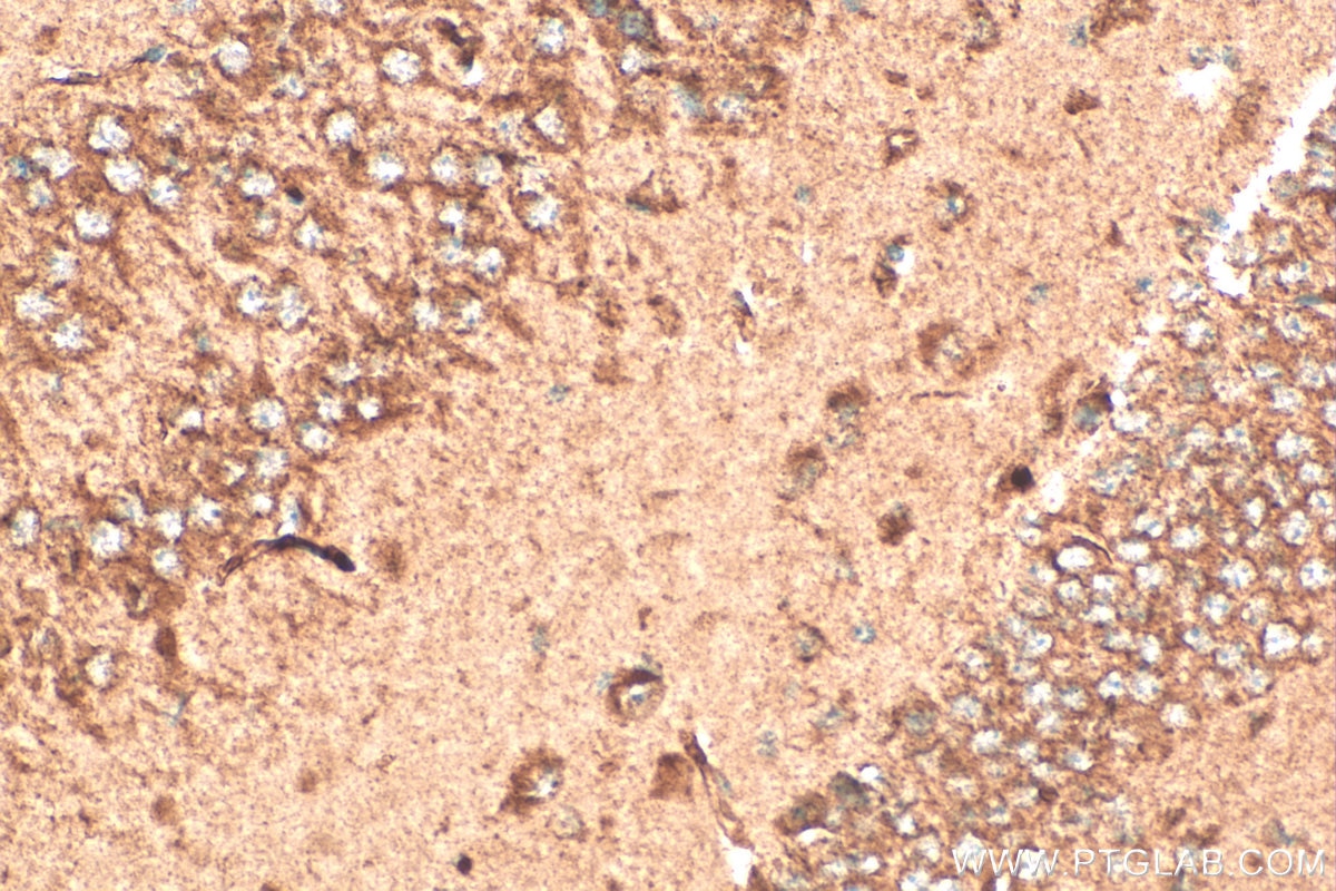 Immunohistochemistry (IHC) staining of mouse brain tissue using SERPINE2 Polyclonal antibody (11303-1-AP)