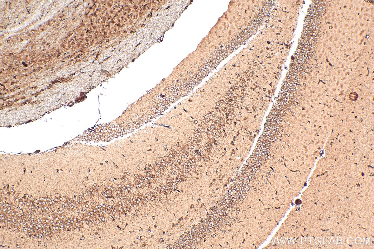 Immunohistochemistry (IHC) staining of mouse brain tissue using SERPINE2 Polyclonal antibody (11303-1-AP)