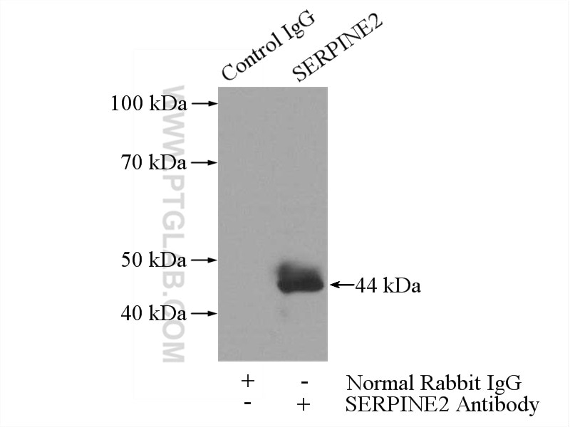 Immunoprecipitation (IP) experiment of A549 cells using SERPINE2 Polyclonal antibody (11303-1-AP)