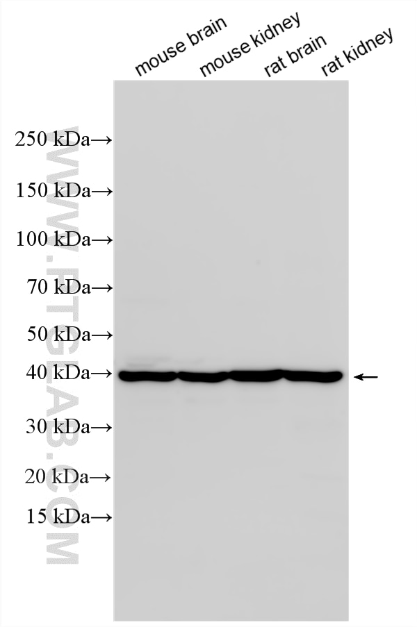 Various lysates were subjected to SDS PAGE followed by western blot with 11303-1-AP (SERPINE2 antibody) at dilution of 1:10000 incubated at room temperature for 1.5 hours. Western Blot (WB) analysis of various lysates using SERPINE2 Polyclonal antibody (11303-1-AP)