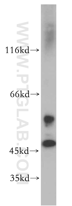 Western Blot (WB) analysis of rat heart tissue using SERPINE2 Polyclonal antibody (11303-1-AP)