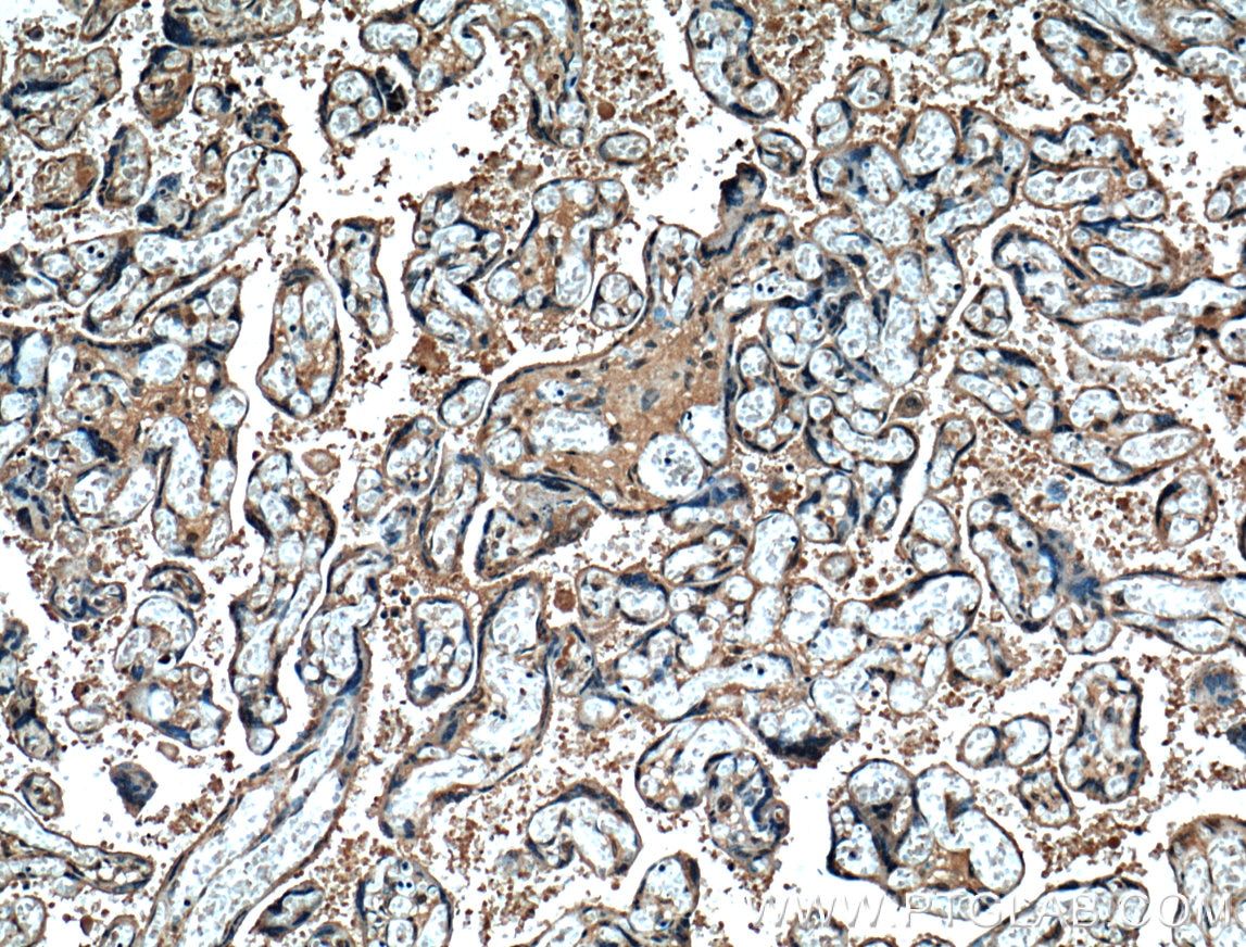 Immunohistochemistry (IHC) staining of human placenta tissue using SERPINE2 Monoclonal antibody (66203-1-Ig)