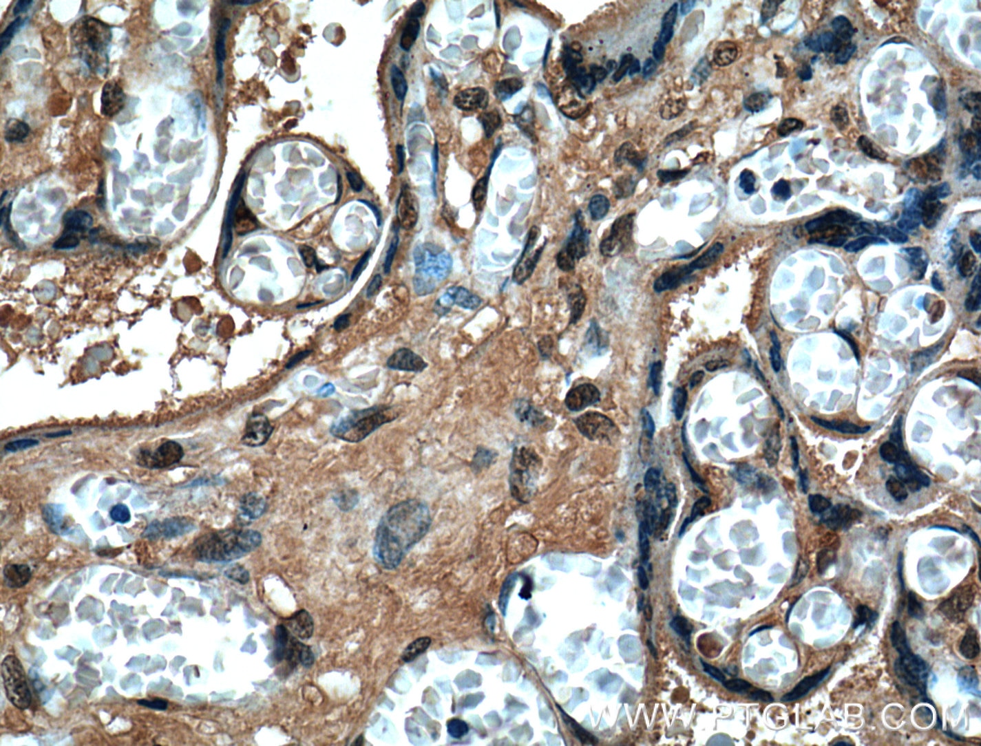 IHC staining of human placenta using 66203-1-Ig