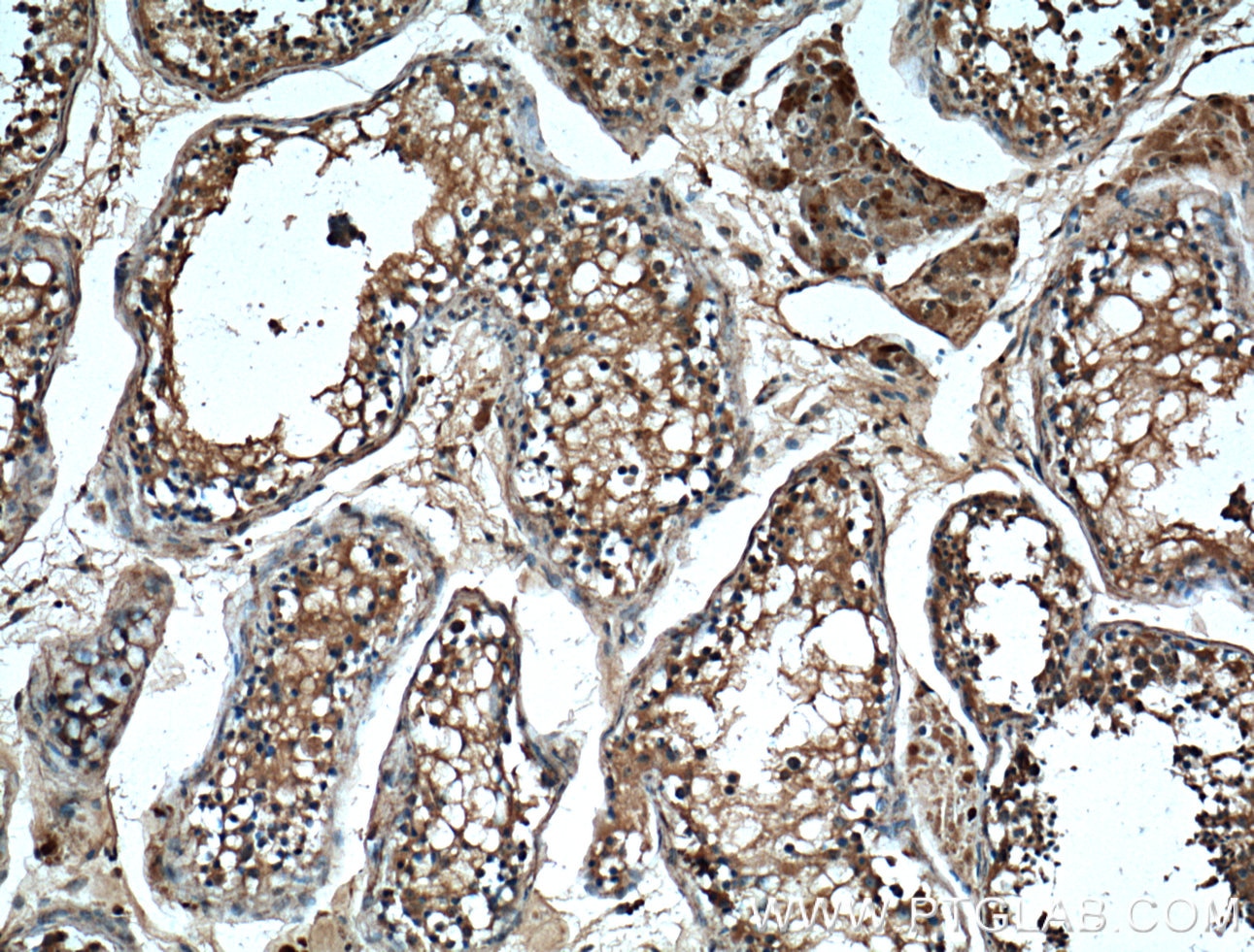 Immunohistochemistry (IHC) staining of human testis tissue using SERPINE2 Monoclonal antibody (66203-1-Ig)