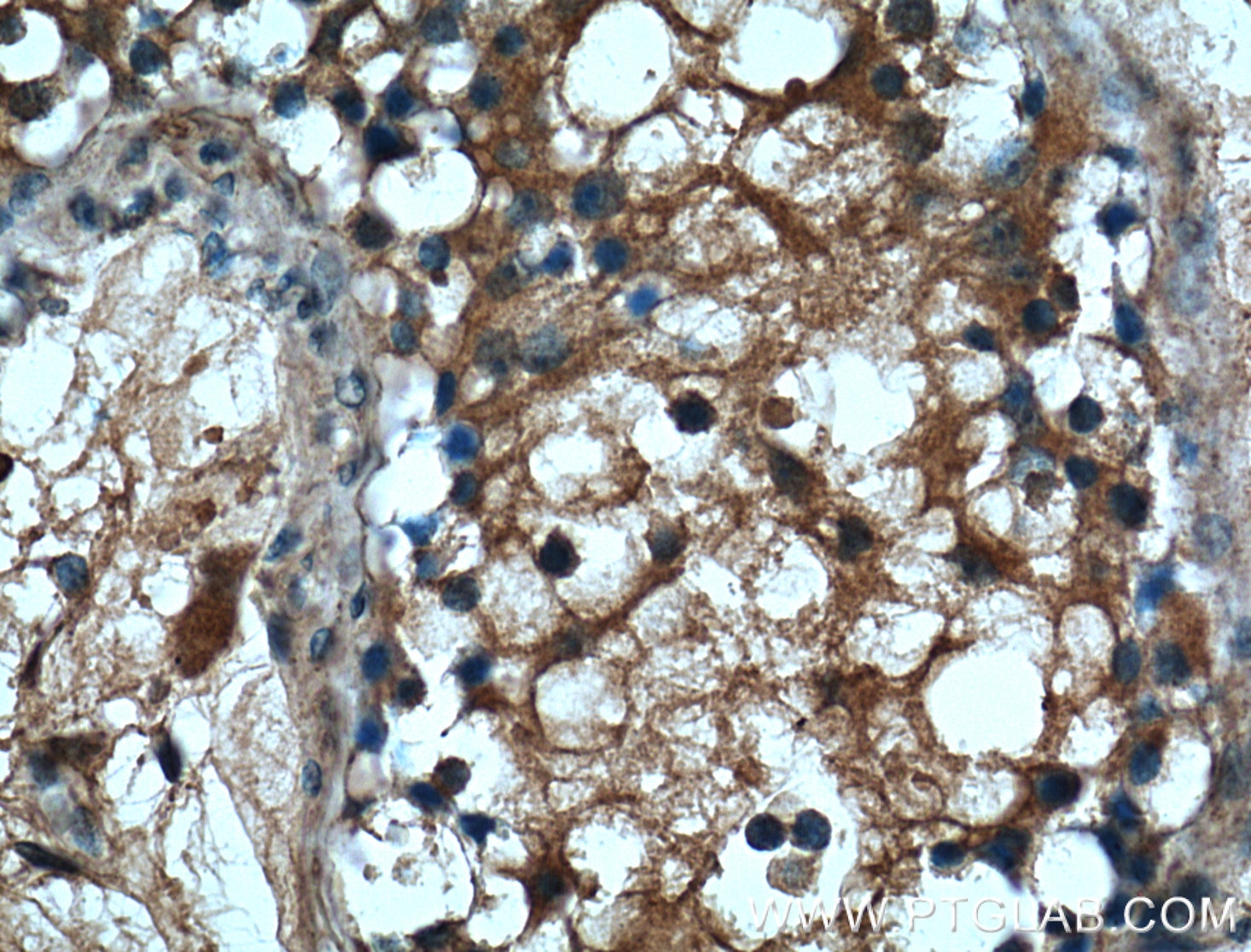 Immunohistochemistry (IHC) staining of human testis tissue using SERPINE2 Monoclonal antibody (66203-1-Ig)