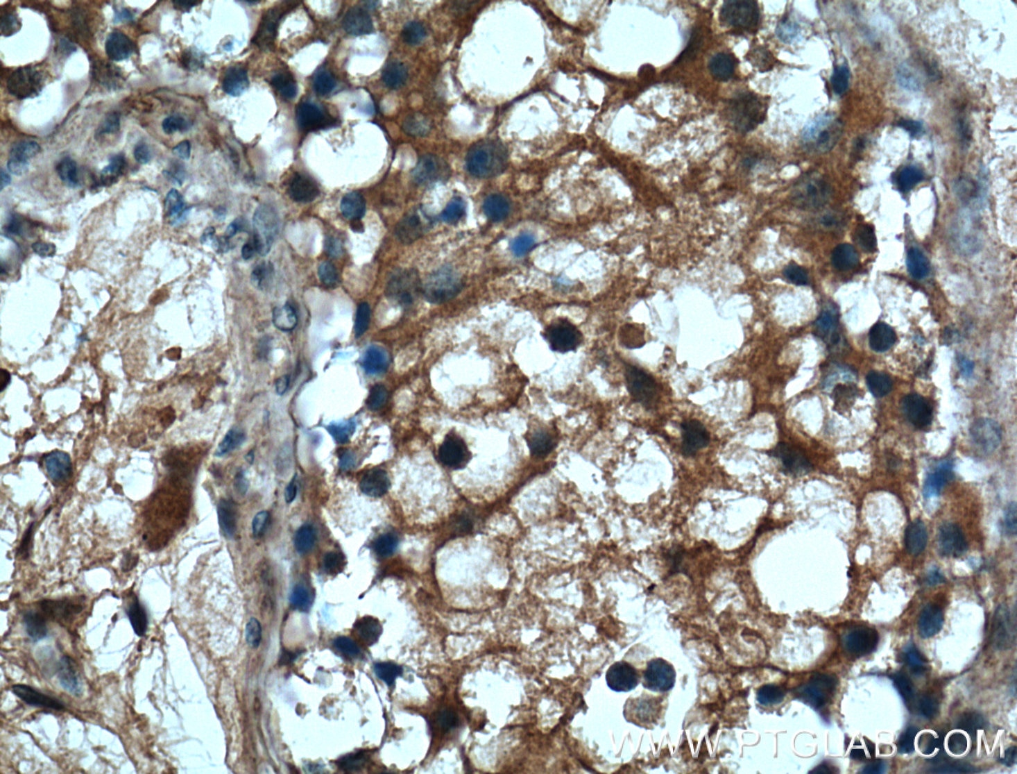 IHC staining of human testis using 66203-1-Ig