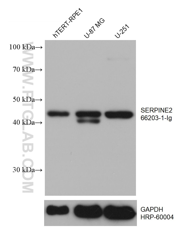 Western Blot (WB) analysis of various lysates using SERPINE2 Monoclonal antibody (66203-1-Ig)