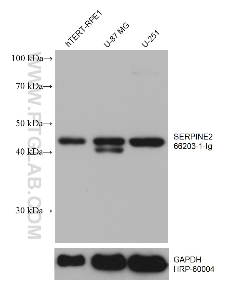 WB analysis using 66203-1-Ig