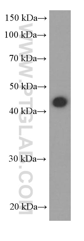 WB analysis of C6 using 66203-1-Ig
