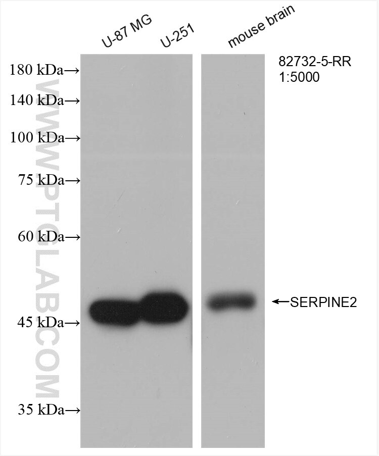 Western Blot (WB) analysis of various lysates using SERPINE2 Recombinant antibody (82732-5-RR)