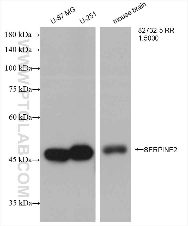 Western Blot (WB) analysis of various lysates using SERPINE2 Recombinant antibody (82732-5-RR)