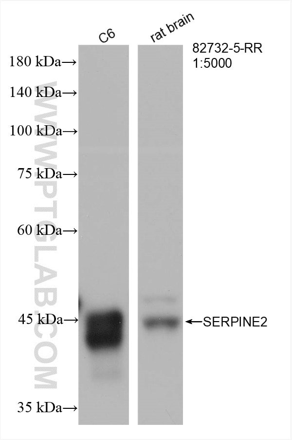 Western Blot (WB) analysis of various lysates using SERPINE2 Recombinant antibody (82732-5-RR)