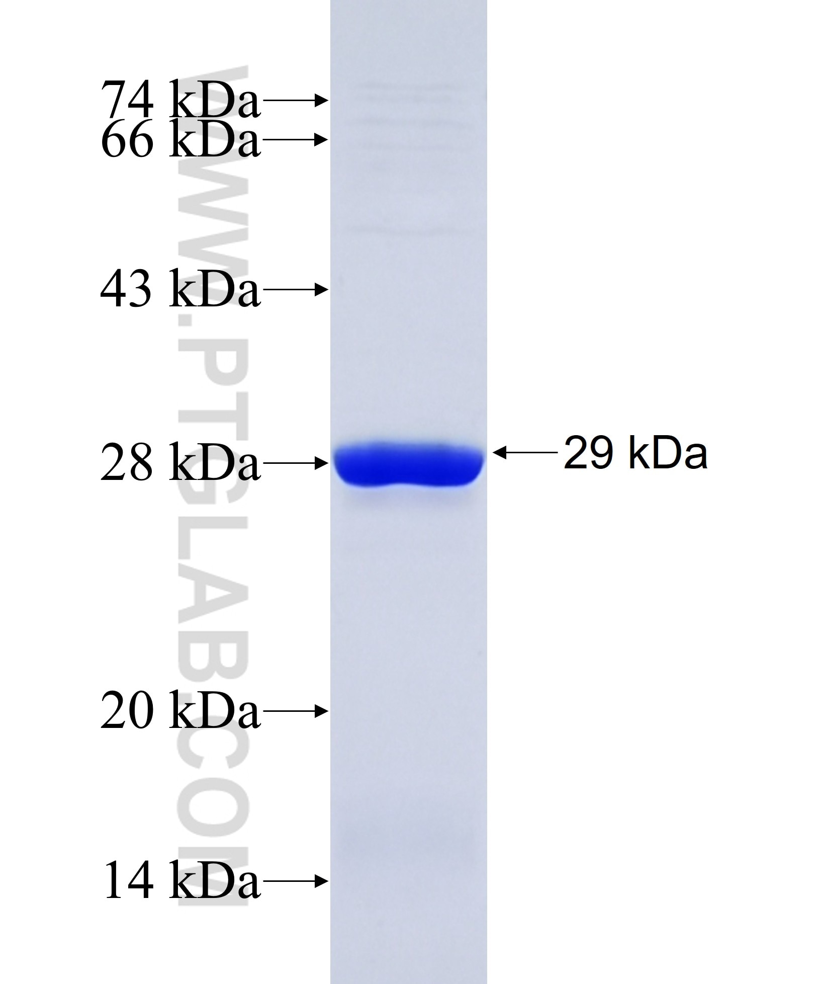 SERPINE2 fusion protein Ag32569 SDS-PAGE SERPINE2 fusion protein Ag32569 SDS-PAGE