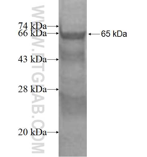 SERPINF1 fusion protein Ag1889 SDS-PAGE