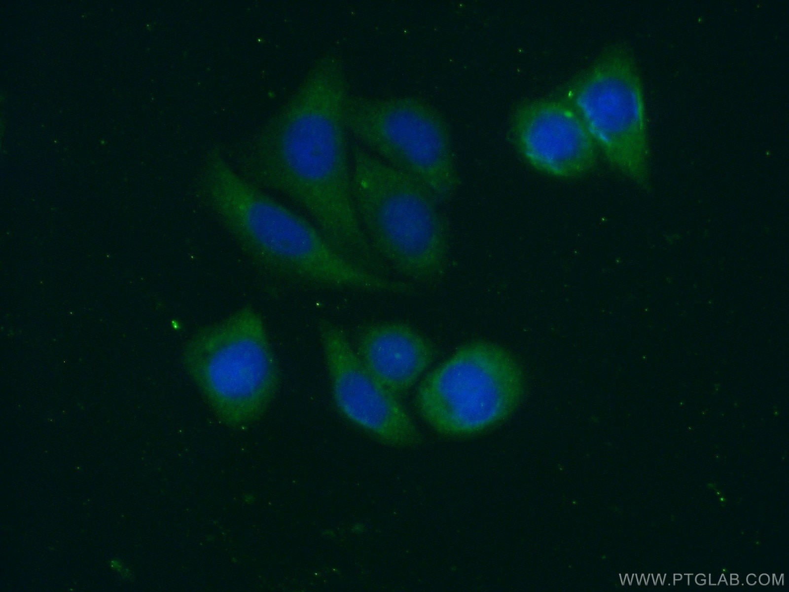 Immunofluorescence (IF) / fluorescent staining of HepG2 cells using Alpha 2-Antiplasmin Polyclonal antibody (13228-1-AP)