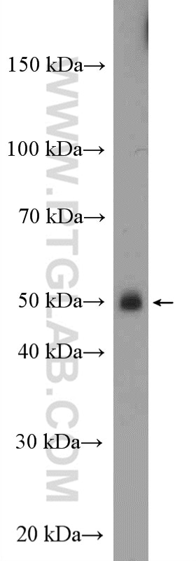 WB analysis of K-562 using 13228-1-AP