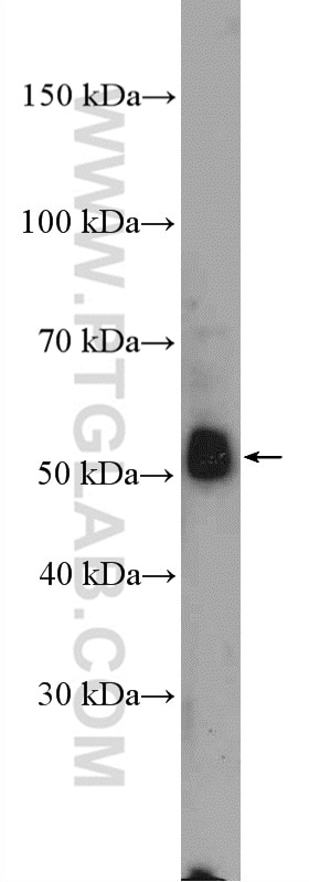 Western Blot (WB) analysis of HepG2 cells using Alpha 2-Antiplasmin Polyclonal antibody (13228-1-AP)