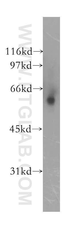 WB analysis of human liver using 13228-1-AP