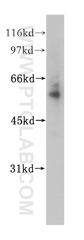 Western Blot (WB) analysis of human liver tissue using Alpha 2-Antiplasmin Polyclonal antibody (13228-1-AP)