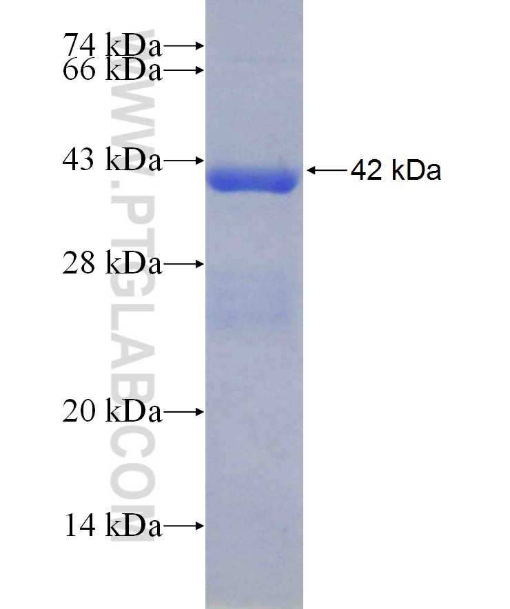 SERPINF2 fusion protein Ag29670 SDS-PAGE
