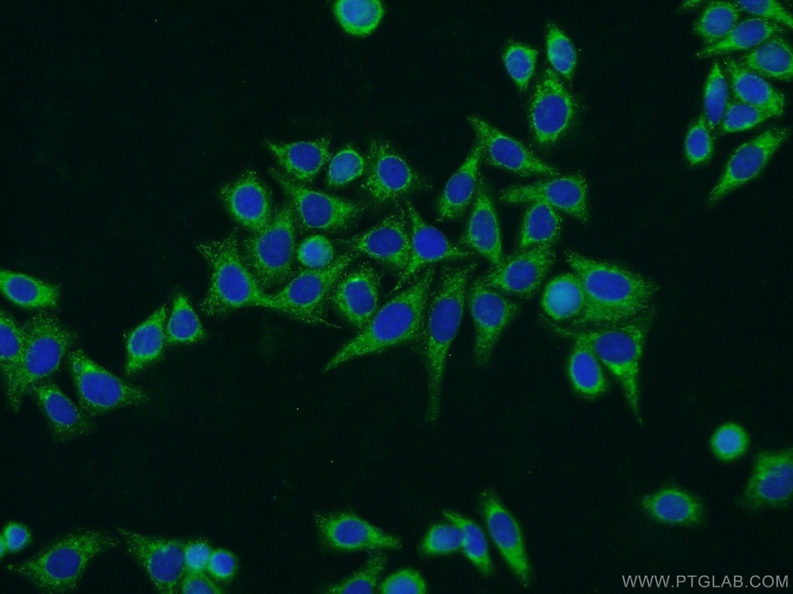 Immunofluorescence (IF) / fluorescent staining of HepG2 cells using SERPING1/C1 Inactivator Polyclonal antibody (12259-1-AP)