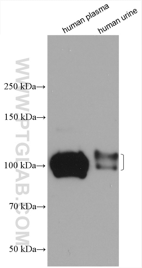 Western Blot (WB) analysis of various lysates using SERPING1/C1 Inactivator Polyclonal antibody (12259-1-AP)