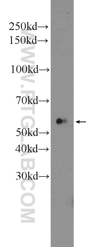 Western Blot (WB) analysis of mouse liver tissue using SERPING1/C1 Inactivator Polyclonal antibody (12259-1-AP)