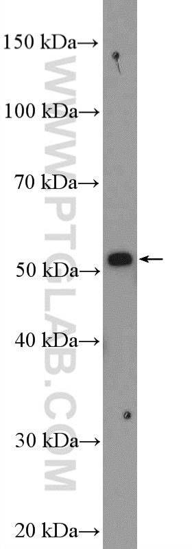 Western Blot (WB) analysis of L02 cells using SERPING1/C1 Inactivator Polyclonal antibody (12259-1-AP)