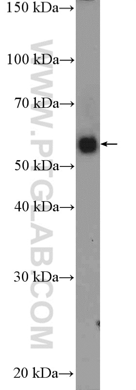 Western Blot (WB) analysis of mouse liver tissue using SERPING1/C1 Inactivator Polyclonal antibody (12259-1-AP)