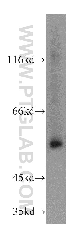 Western Blot (WB) analysis of HeLa cells using SERPING1/C1 Inactivator Polyclonal antibody (12259-1-AP)