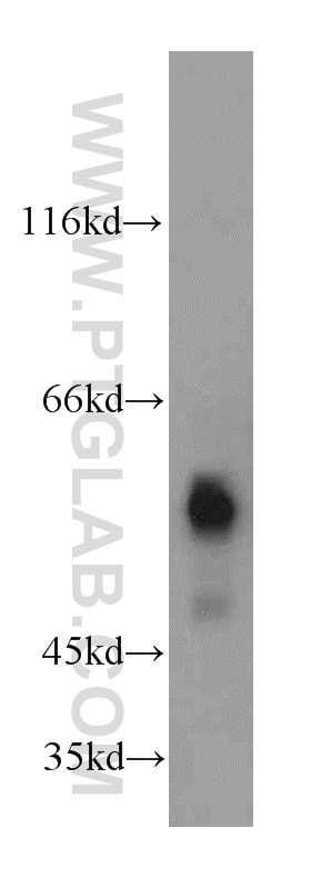 Western Blot (WB) analysis of human liver tissue using SERPING1/C1 Inactivator Polyclonal antibody (12259-1-AP)